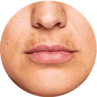 GloraMD 
