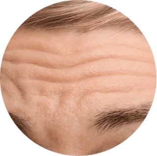 GloraMD 