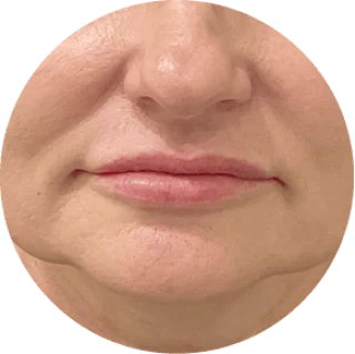 GloraMD 