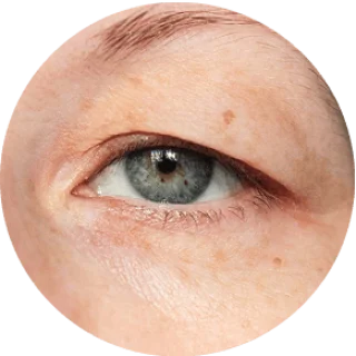 GloraMD 